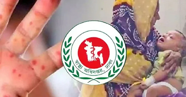 ২৪ ঘণ্টায় হাম উপসর্গে ৮ জনের মৃত্যু
